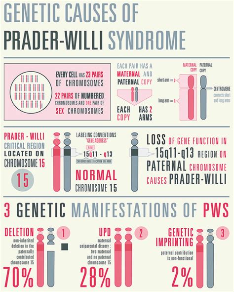 booktopia prada willy|does prader willi cause stomach pain.